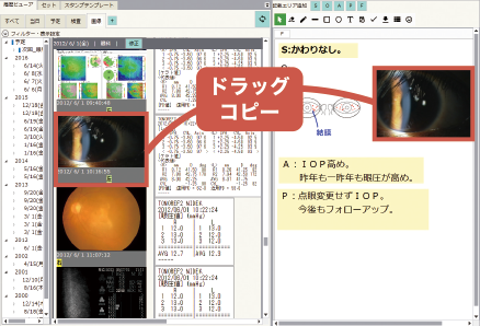 画像ファイリングシステム「Claio」